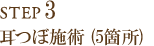 Step3  gCAE